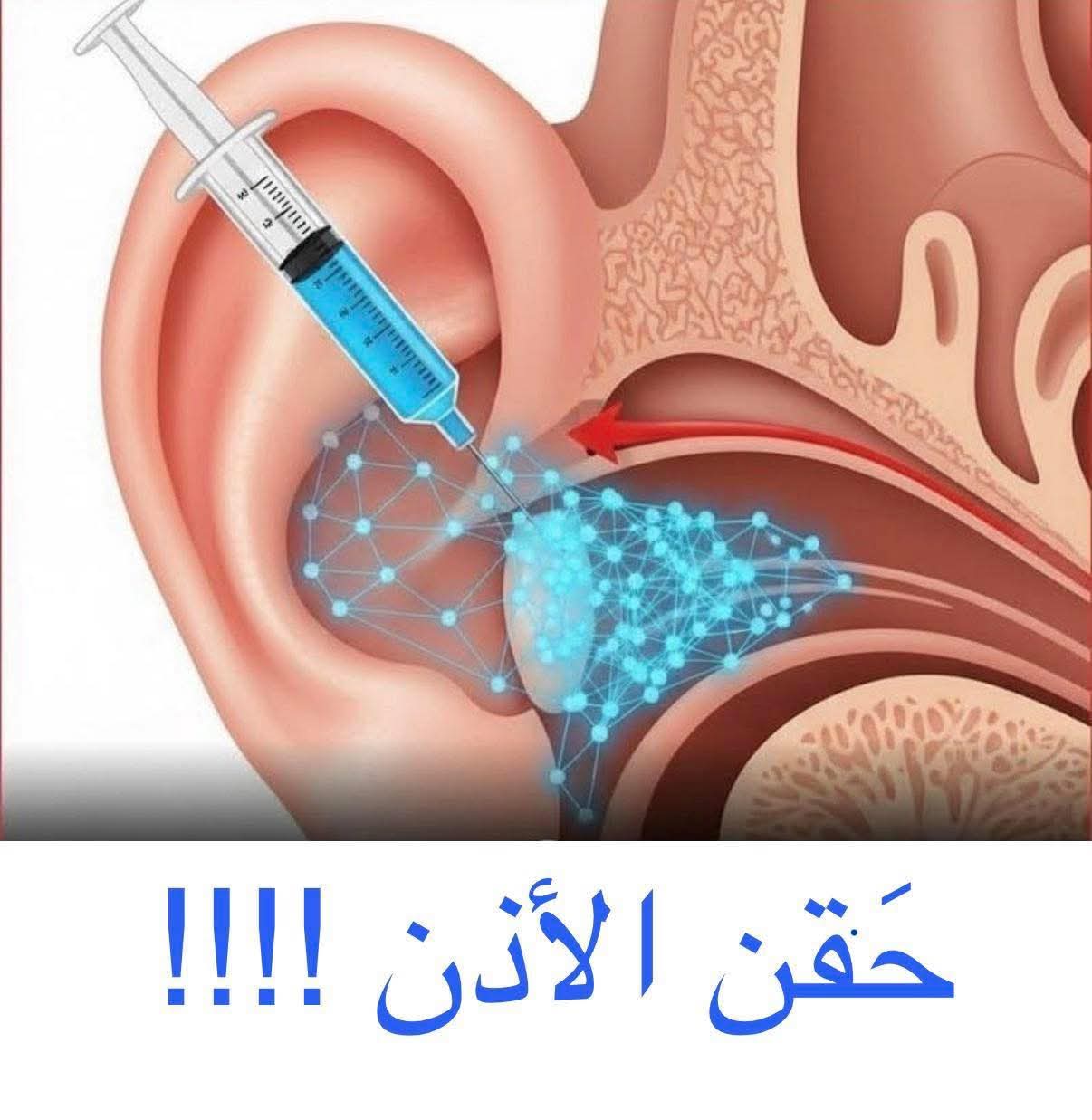 حقن عصب السمع؟ الحقيقة العلمية ⚠️