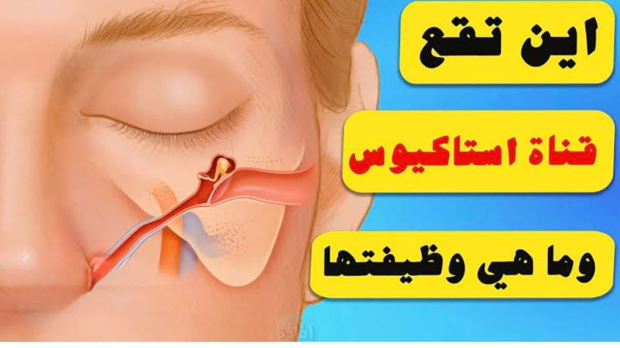 حاسس ودنك مقفولة؟ ممكن تكون قناة استاكيوس
